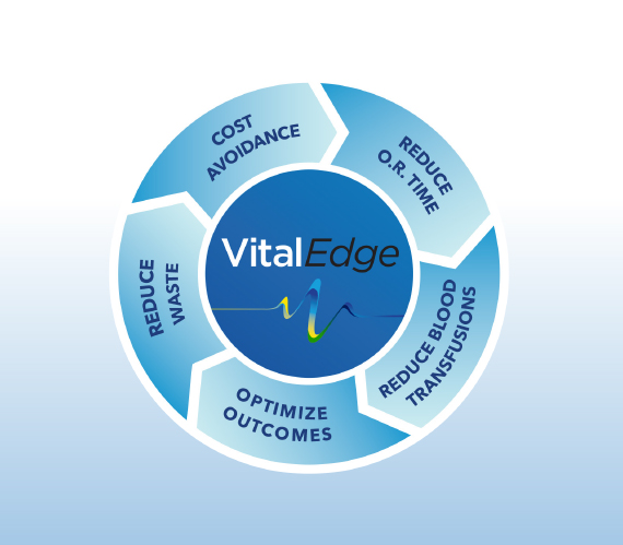 Image of the Vital Edge wheel with Vital Edge logo in the middle and the components of VE on the outer edges of the wheel.