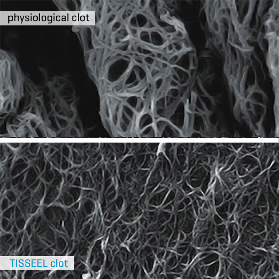 Two black and white images of clots - a physiological clot and a TISSEEL clot